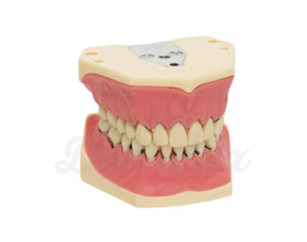 A-PZ: Modelo periodontal com dentes aparafusados Img: 202104171