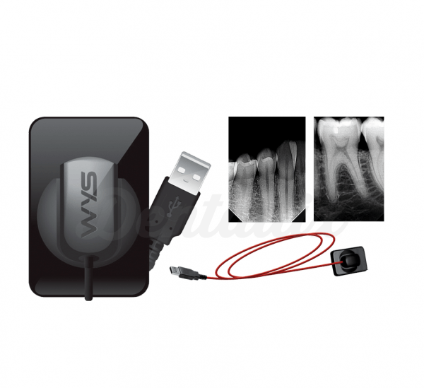 Captador WYS - Sensor Radiología Intraoral USB CMOS Img: 201807031