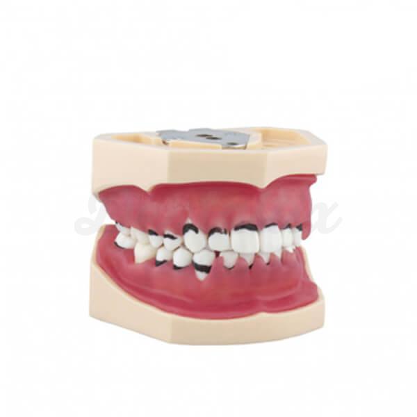 TIPODONTO DE PERIODONCIA COMPLETO  Img: 202109111