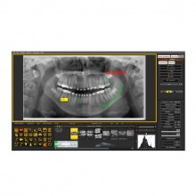Mediadent: Software de Gestão de Imagem Dentária Img: 202107101