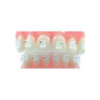 Brackets de Safira (20 pcs) - Roth 018 Img: 202203191