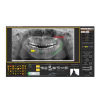Mediadent: Software de Gestão de Imagem Dentária Img: 202107101