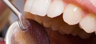 5 claves para aumentar el porcentaje de aceptación de tratamientos dentales en tu consulta.