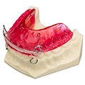 Attivatore dentale ortodontico