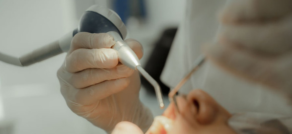 Aeropulidores dentales: Cómo elegir el mejor para tu clínica dental