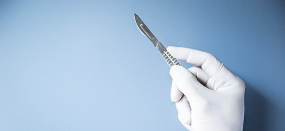 Tipos de Bisturí en Odontología: Descubre los más utilizados