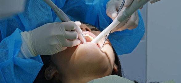 La revolución en profilaxis dental: Ultrasonidos y aeropulidores combinados