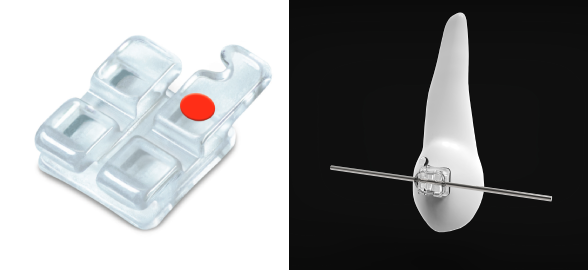 ¿Cómo elegir el bracket Ortho Technology más adecuado? 
