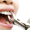 Cirugía oral y periodoncia