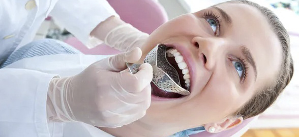 ¿Cómo elegir la cubeta de impresión dental más adecuada?