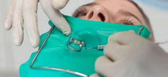 Diques de goma en Aislamientos dentales: ¡Características y usos!