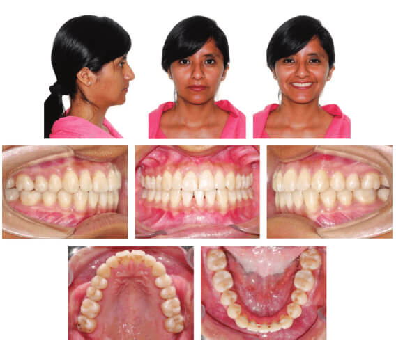 Fotografia intraoral