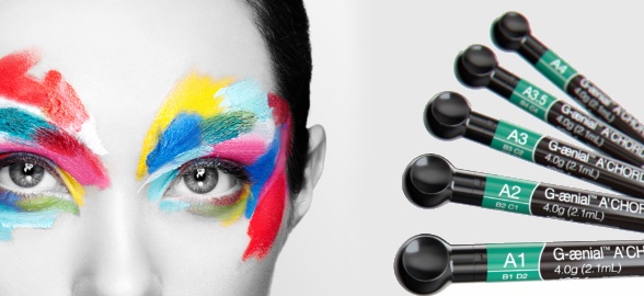 Caso práctico de estratificación con G-aenial A`CHORD de GC: Restauración directa clase IV