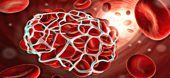 Hemostasia en Odontología: las soluciones más eficientes en la clínica dental