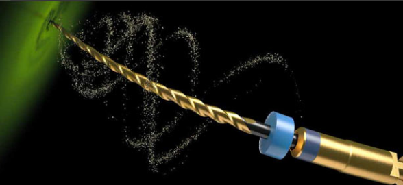 Aleaciones de Níquel-Titanio (NiTi): Las limas de endodoncia más resistentes al estrés por flexión