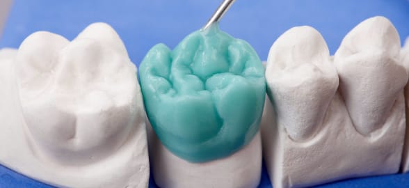 La guía más completa sobre las ceras dentales