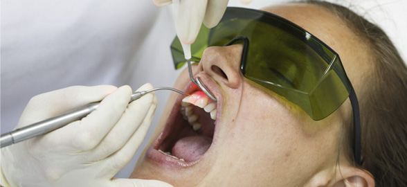 Láser de diodo en odontología: ¿Por qué incorporarlo a tu clínica dental?