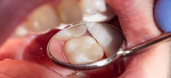 Línea de Restauración Medicaline: consigue tratamientos estéticos y duraderos con el mejor balance precio - calidad