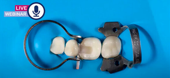 Webinar Medicaline: "Restauraciones directas ¿cómo hacerlo fácil?”