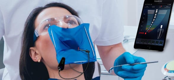 Cómo el localizador apical mejora la eficacia de las endodoncias dentales