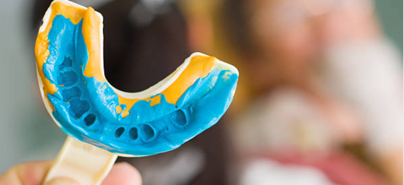 Principales materiales de impresión dental: Todo lo que necesitas saber sobre alginatos y siliconas
