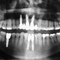 Radriografía Odontología