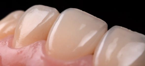 Guía completa de reconstrucción dental con composite para odontólogos: técnicas, materiales y mejores prácticas