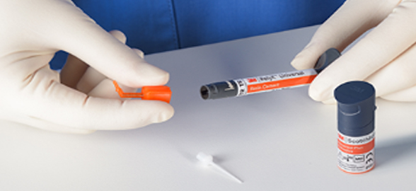 3M RelyX Universal: Simplificando la Cementación dental