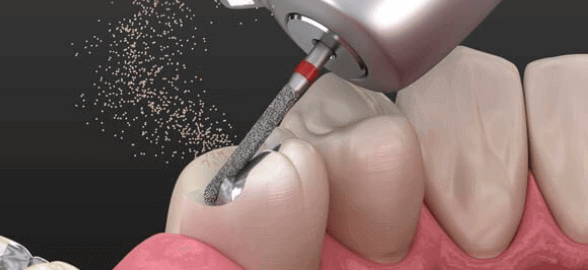 Guía de sostenibilidad: Prácticas sostenibles para la gestión de residuos tóxicos generados en la clínica dental