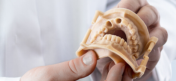 Resinas para laboratorio dental: Tipos, para qué se utilizan en odontología y avances