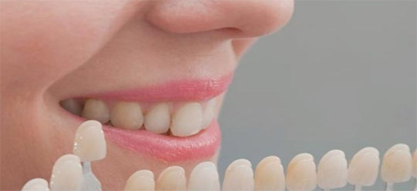 Composite Aura Easy de SDI: Restaurando la función y la estética dental