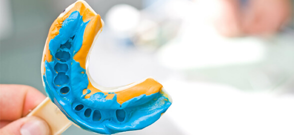 Guía completa sobre siliconas de adición: La clave para una impresión precisa