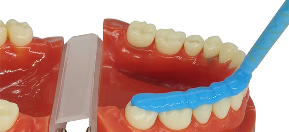 Todo sobre el registro de mordida con silicona: Uso y consejos prácticos