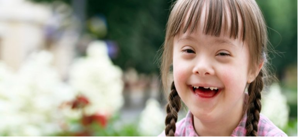 Lo que debes saber antes de atender a un niño con Síndrome de Down en tu clínica