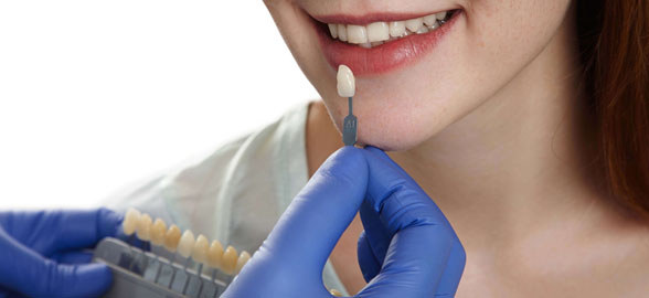 La Nueva Era de los Composites Dentales con Adaptabilidad Cromática