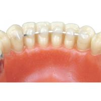 Alambre para Splinting (1,5 m) Img: 202203051