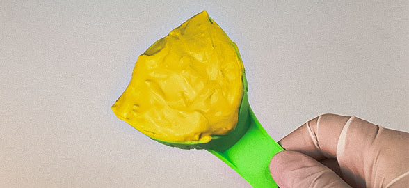 Todo lo que necesitas saber sobre los alginatos dentales y su uso en impresión dental