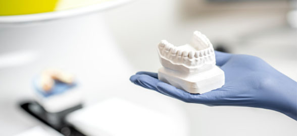 Todos los tipos de yesos y escayolas dentales: usos y clasificación